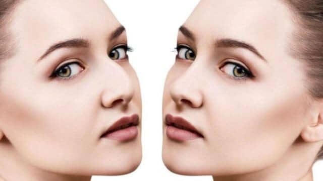 Rhinoplastie Tunisie