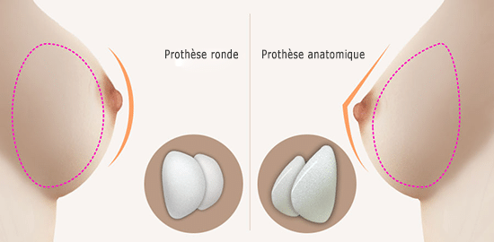 Rhinoplastie Tunisie