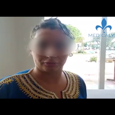 Chirurgie esthetique tunisie