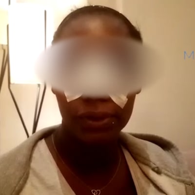 Chirurgie esthetique tunisie