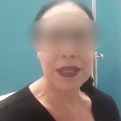 Chirurgie esthetique tunisie