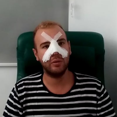 Chirurgie esthetique tunisie