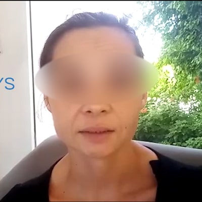 Chirurgie esthetique tunisie