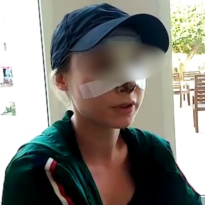 Chirurgie esthetique tunisie