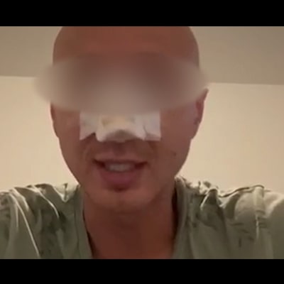 Chirurgie esthetique tunisie